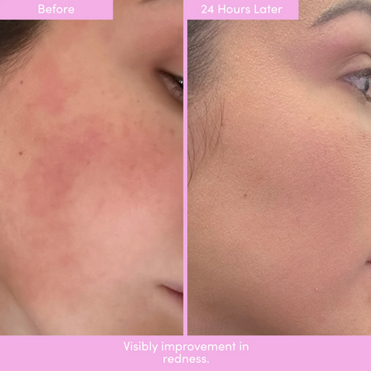 PEP TALK™ Bio-Placenta Barrier Repair Cream for Redness & Dryness