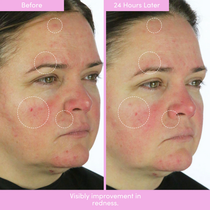 PEP TALK™ Bio-Placenta Barrier Repair Cream for Redness & Dryness