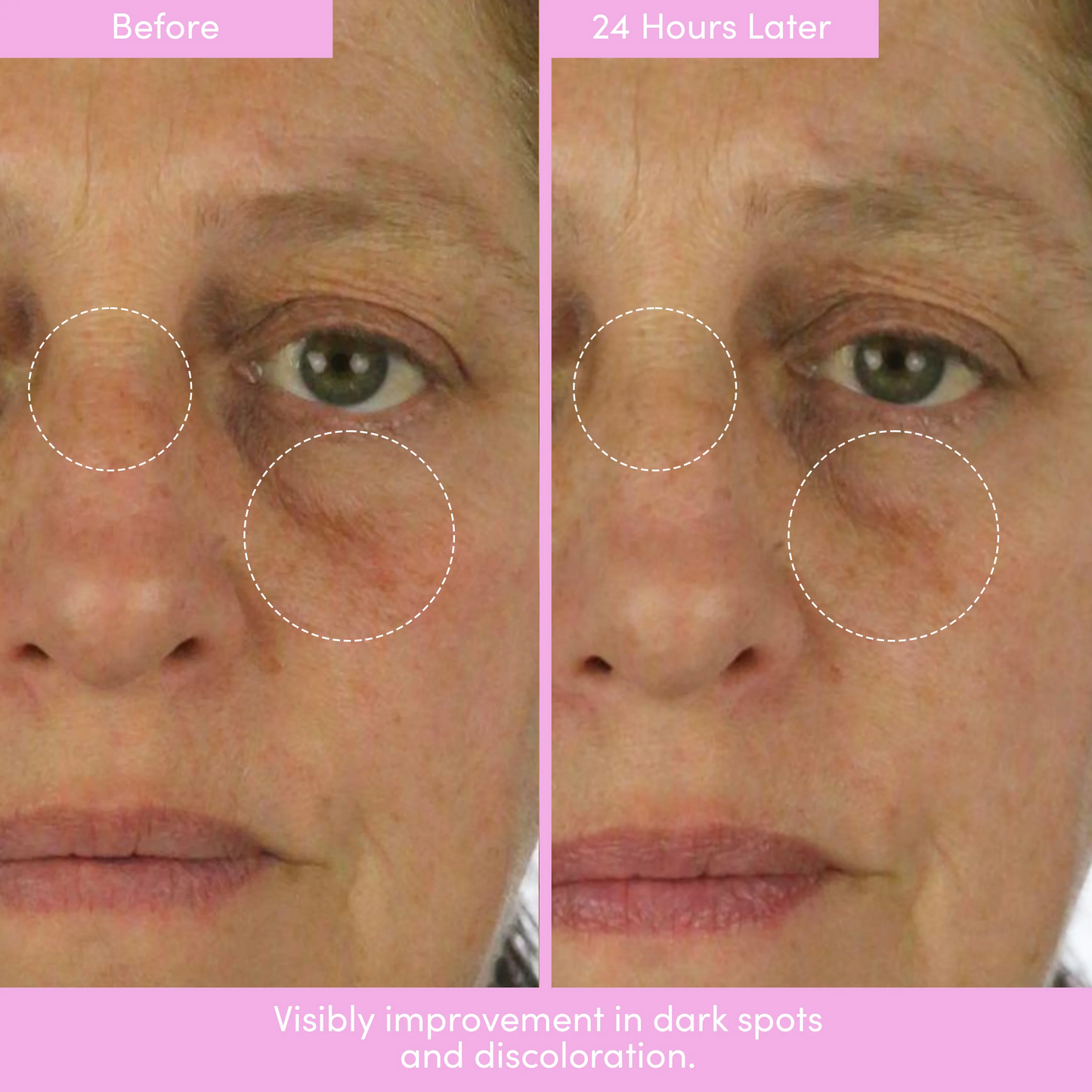 PEP TALK™ Bio-Placenta Barrier Repair Cream for Redness & Dryness